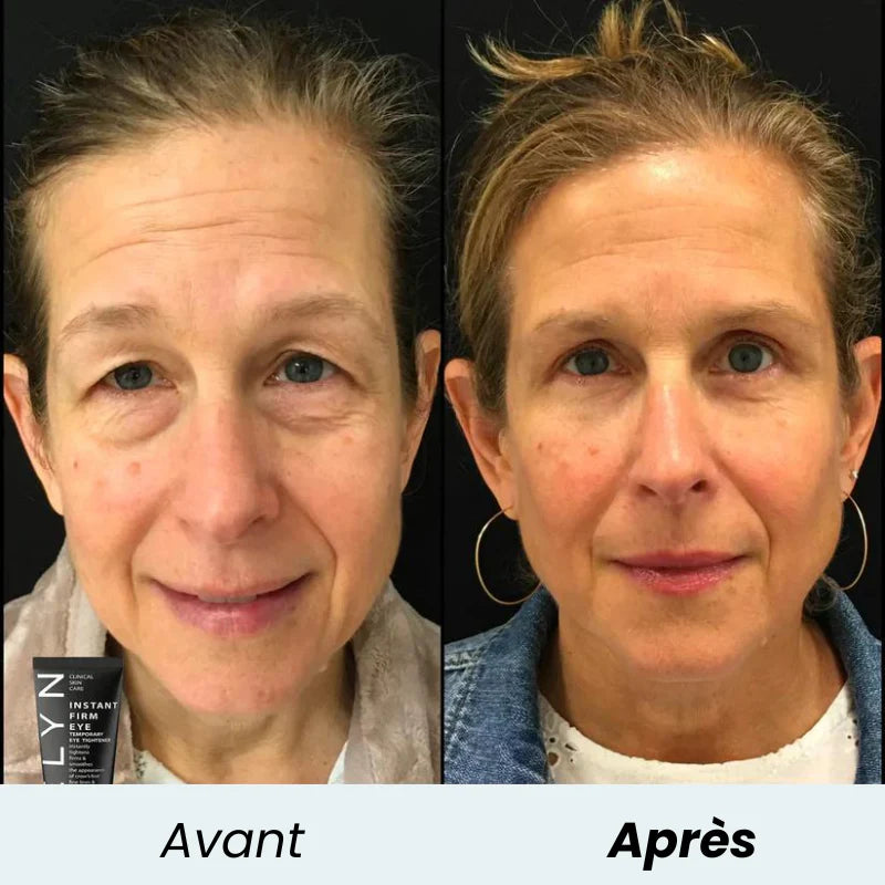 EyeLift Instant™ – Crème Contour des Yeux Effet Lift Immédiat