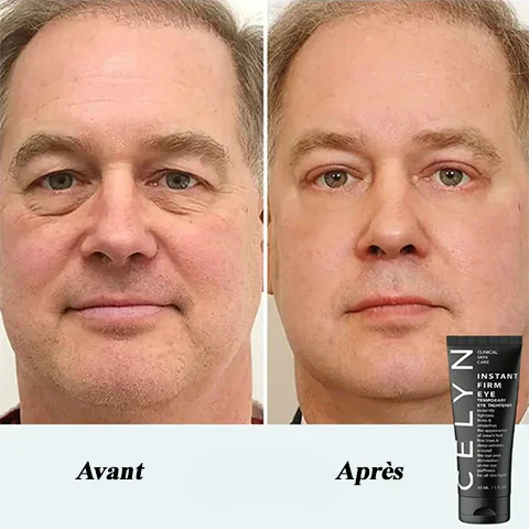 EyeLift Instant™ – Crème Contour des Yeux Effet Lift Immédiat