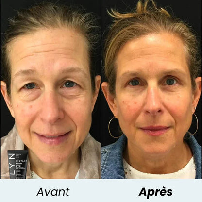 EyeLift Instant™ – Crème Contour des Yeux Effet Lift Immédiat
